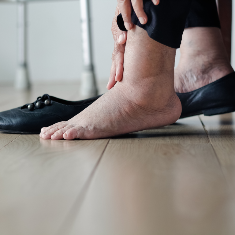 Essential Oils for Swollen Feet: The Best Options for Relief